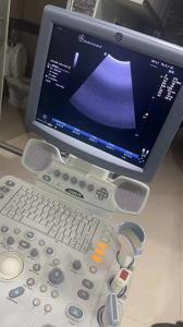 Quality GE original OB/GYN ultrasound machine LogiqP5 wholesale