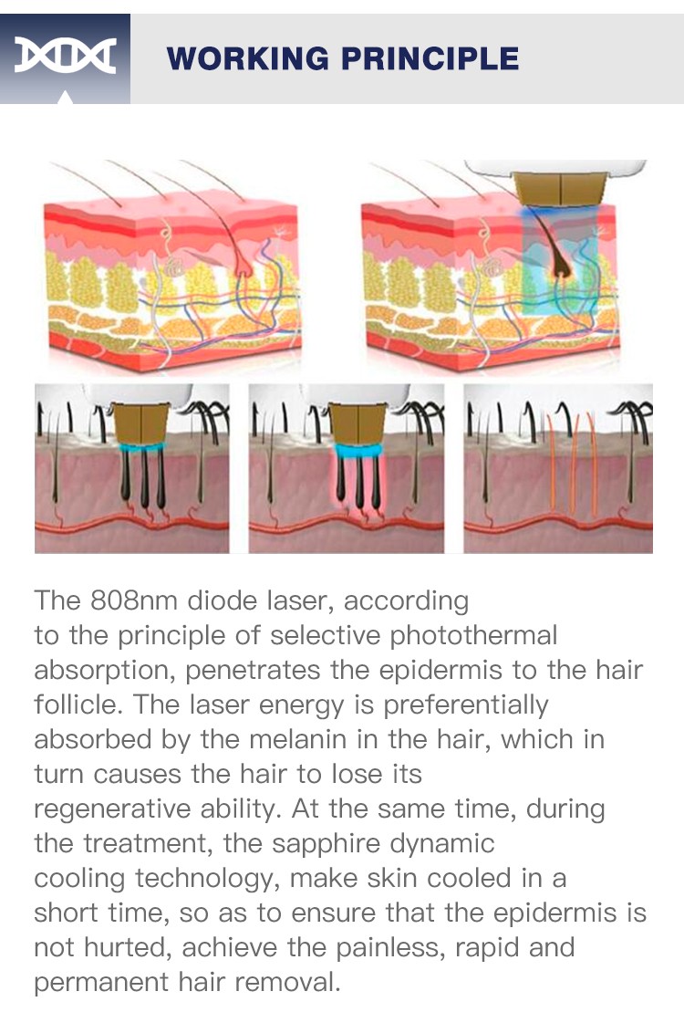 Logo Service 1800w 60 million shot Painless Skin Rejuvenation 808 nm Diode Laser Epilator Hair Removal Laser Machine