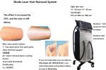 Professional Laser Hair Removal Device Stationary Laser Depilation Machine 808nm