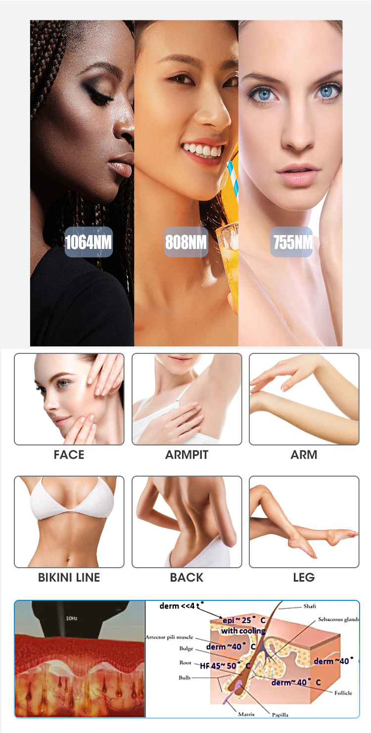 Android Hair Laser Machines 808 Nm Diode Laser Hair Removal Permanent