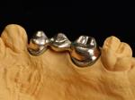 Audental 90 Dental Restorations High Noble Alloy , Dental Ceramic Alloy Yellow