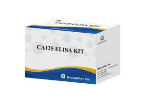Quality Colorimetric Ca125 Elisa Test Kit Professional Diagnostic Tool For Accurate Results wholesale