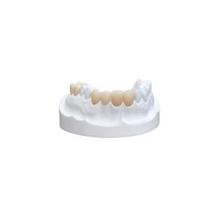 Quality Inlays Onlays Ceramic Dental Crown Strong Veneer For Dental Department wholesale