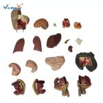 55cm Unisex Human Torso Skeleton Anatomy 20 Parts