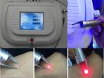 Non-invasive laser vascular treatment 980nm diode laser spider vein removal