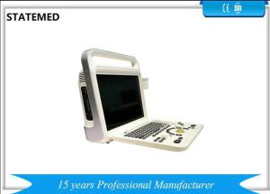 China White Color Portable Color Doppler Ultrasound Scanner For Hospital Clinic on sale