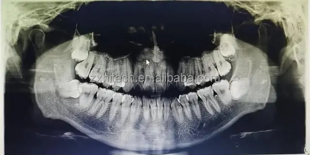 Dental CT 3D CBCT Digital X Ray Equipment China