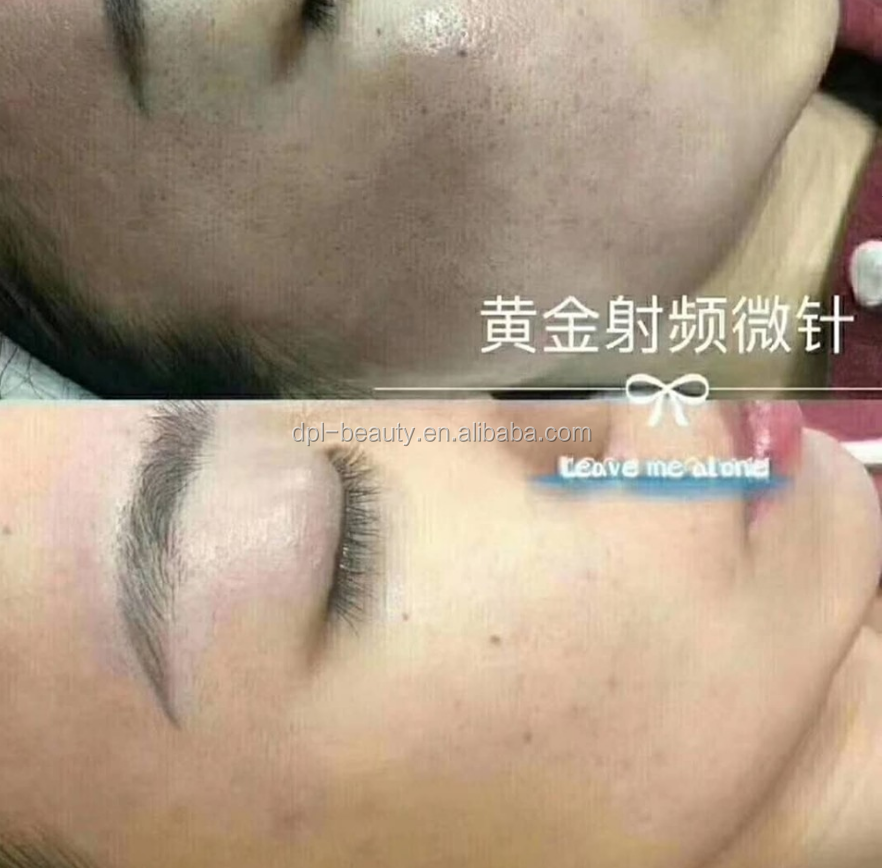 Facial Care Radio Frequency Microneedling Machine , RF Fractional Machine 200W