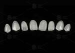 Natural Pressed EMAX Veneer Strength 16 Shades Emax Teeth Veneers
