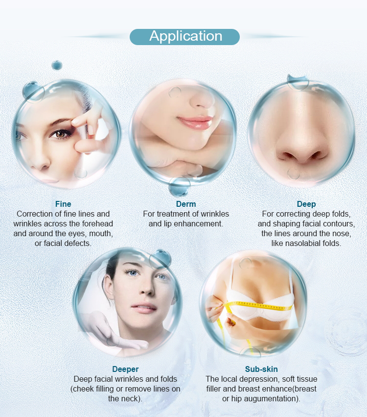 24mg/Ml BDDE Sodium Hyaluronic Acid Wrinkle Fillers For Eye Wrinkle