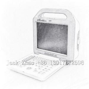 Quality Medbes Full Digital Compact Color Doppler Pregnancy Scanner Ultrasound Machine wholesale
