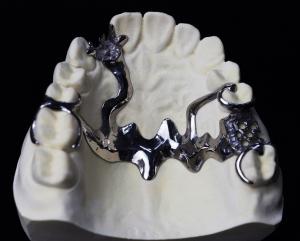 China Cr Co Partial Denture Metal Framework on sale