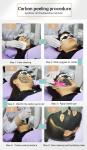 100-2000mj Photo Rejuvenation Machine 300w Nd Yag 1064 Laser
