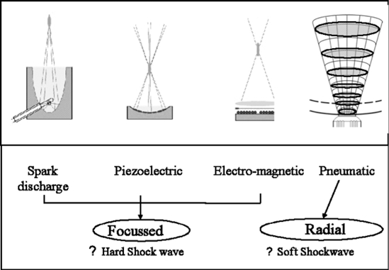 Lifotronic Physical Therapy Device Shockwave Therapy Extracorporeal Shockwave ESWT Zimmer
