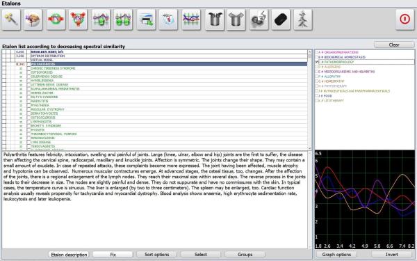 Effective Herald Meridian Therapy Instrument NLS Metatron Metapathia GR Hunter