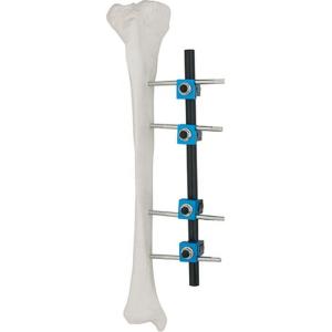 Quality Quality Assured Orthopedic Surgical Instruments Tibial External Fixator AO External Fixation Orthopedic Implant wholesale