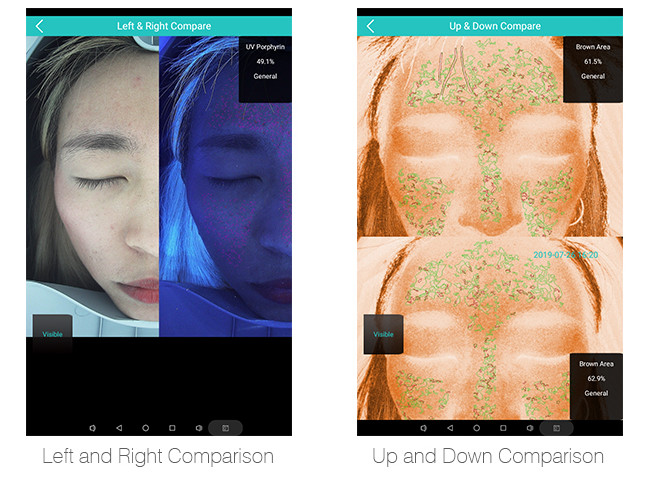 Humanized Design 3d Home Analyzers For Facial Skin 12 Skin Problem Detected