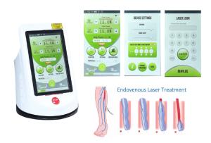 Quality 810nm 980nm Medical Laser Machine Local Anesthesia EVLT wholesale