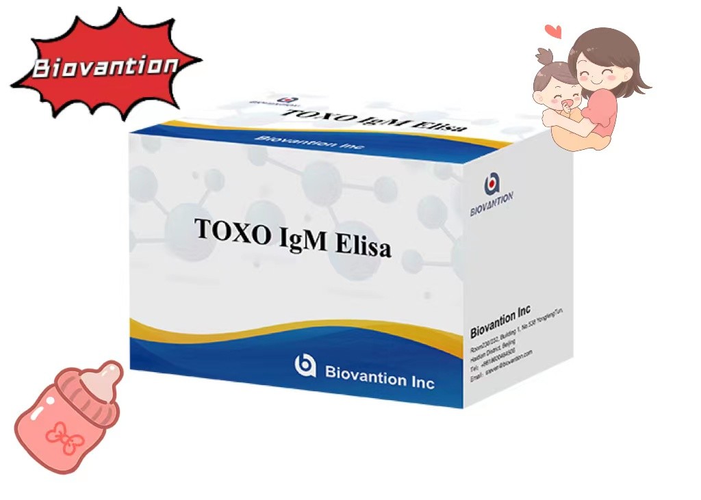 TOXO IgM ELISA Test Kit Torch High Sensitivity Hospital Test Pregnancy Check
