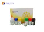 96 Wells Customized Human Corticotropin Releasing Hormone CRH ELISA Kit