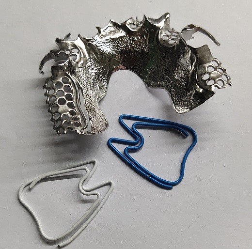 Removable 3D Printed Partial Denture Metal Framework