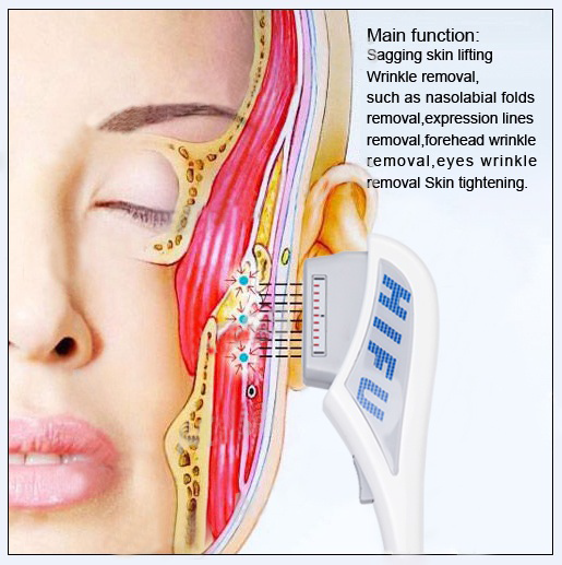 High Intensity Focused Ultrasound Vertical Equipment For Wrinkle Removal Treatment