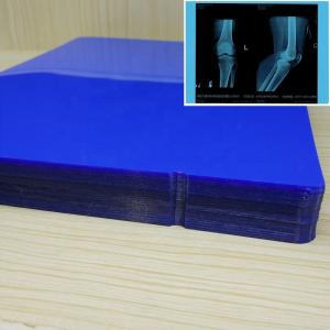 Quality 210 Microns 13X17 Inch Medical Inkjet Film High Contrast PET X Ray Film wholesale
