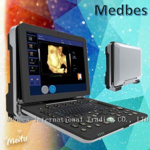 Quality Medical Diagnostic Ultrasounic Machine Hospital Fetal doppler Ultrasound Scanner wholesale
