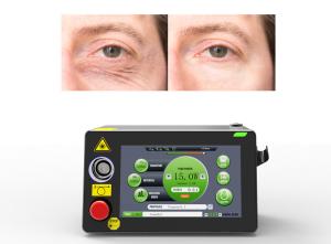Quality 30W Medical Laser Equipment Blepharoplasty Treatment 980nm wholesale