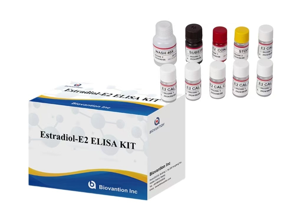 Anti Ds-DNA IgG ELISA Test Kit Qualitative Anti Double Stranded DNA Antibody