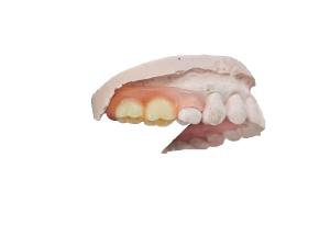 Quality Strong and Durable Gardening Simulation Resin for High Aesthetic Orthodontic Treatment wholesale