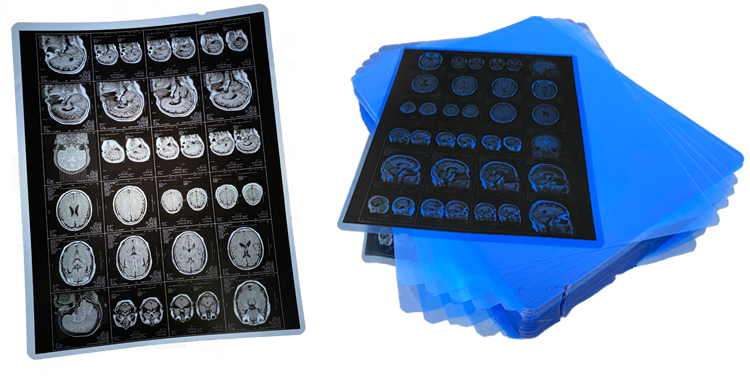 Waterproof 215 Micron PET Based Medical X Ray Film