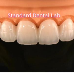 Quality Zirconia Crowns Bridge Dental Lab With Layered Porcelain wholesale