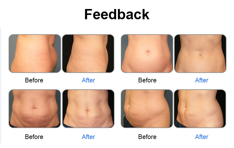 Weight Loss Beauty Machine Non Invasive 6D Laser Shape Slimming Equipment For Waist Trainer
