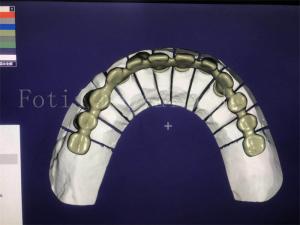 Quality Reliable Effective Dental Design Service Superior And Competitive wholesale