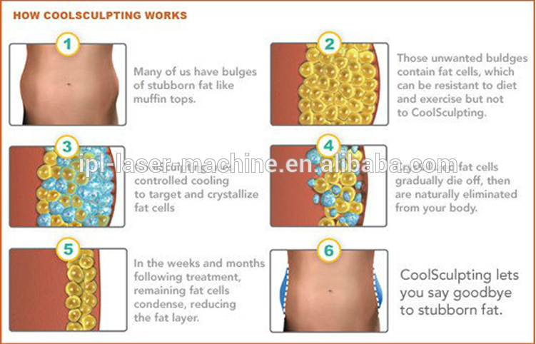 High Quality Body Shape Ultrasound Whole Body Slimming Fat Reduction Cryolipolysis Machine