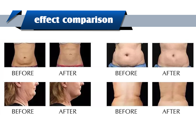 6 in 1 Weight Loss Fat Reduction Burner Slimming Vacuum Therapy Machine