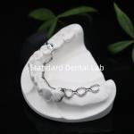 Vitallium 2000 Partial Framework ISO CE And FDA China Dental Lab Metal Framewrok