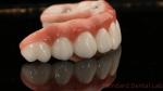 High Quality Dental zirconia crown and All On Four Six Implant Full Arch / China