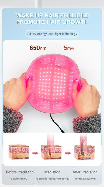 650nm Laser Helmet For Baldness Prevent Treatment Thicker Hair Regrowth