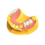 Dental 3D Printing Invisible Denture Base Resin