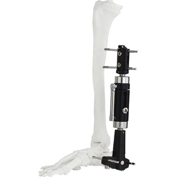 Assured Quality Orthopedic Surgical Instruments Ankle Joint Fragment External