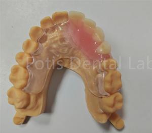 Quality Hypoallergenic Comfort Fit Flexible Valplast Partial TCS Dental Appliance wholesale