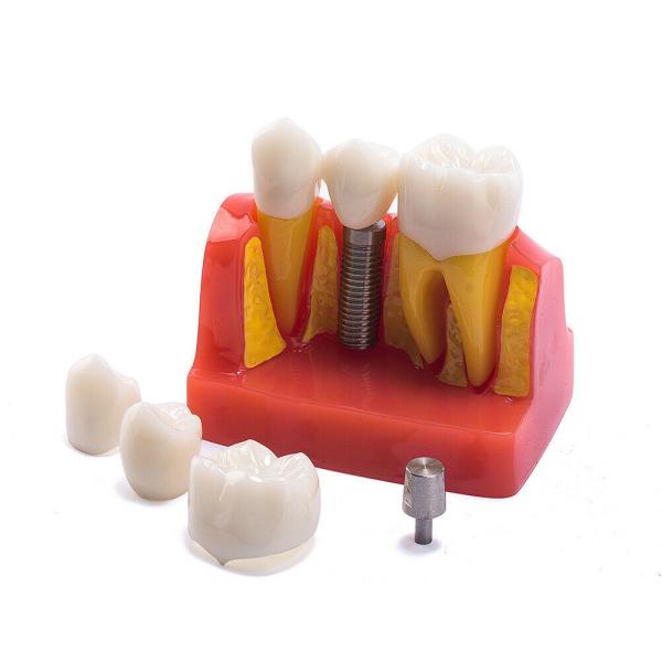 Class III Instrument Classification Dental Study Model for Dental Practice and