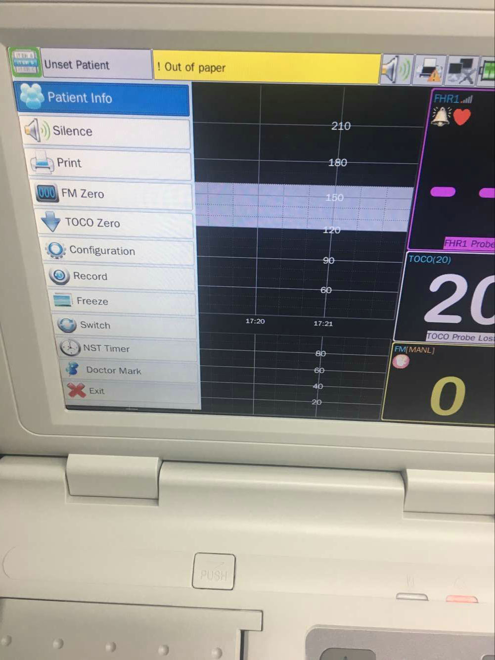 Mars K series ctg machine maternal and fetal doppler monitor for TOCO,FHR,FM MP22