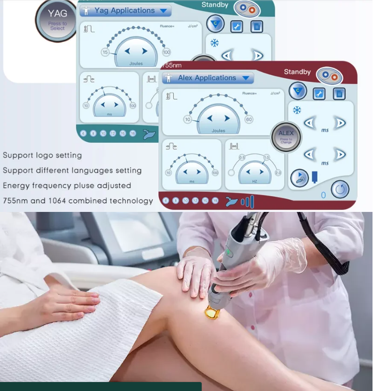 755nm Alexandrite Laser Hair Removal Machine Stationary Style For Commercial
