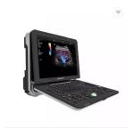 Cardiovascular Cardiology Portable Full Figital Color Doppler Ultrasound Scanner