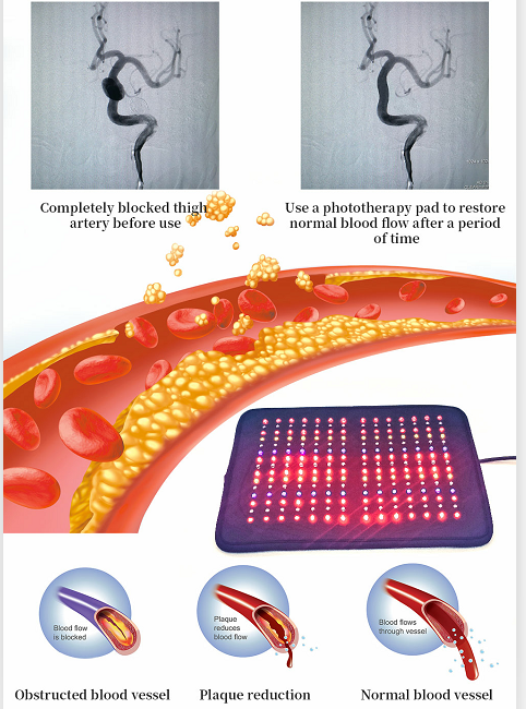 SSCH 405nm Multicolor LED Infrared Light Heating Pad Infrared Pad For Pain Relief