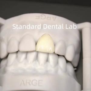 Quality Digital CAD CAM Dental Lab Crowns Translucent Layered Zirconia Crown wholesale