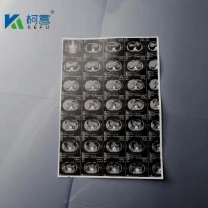 Quality 180um A3 White Inkjet Medical X Ray Film Canon Epson Inkjet Printer Film wholesale
